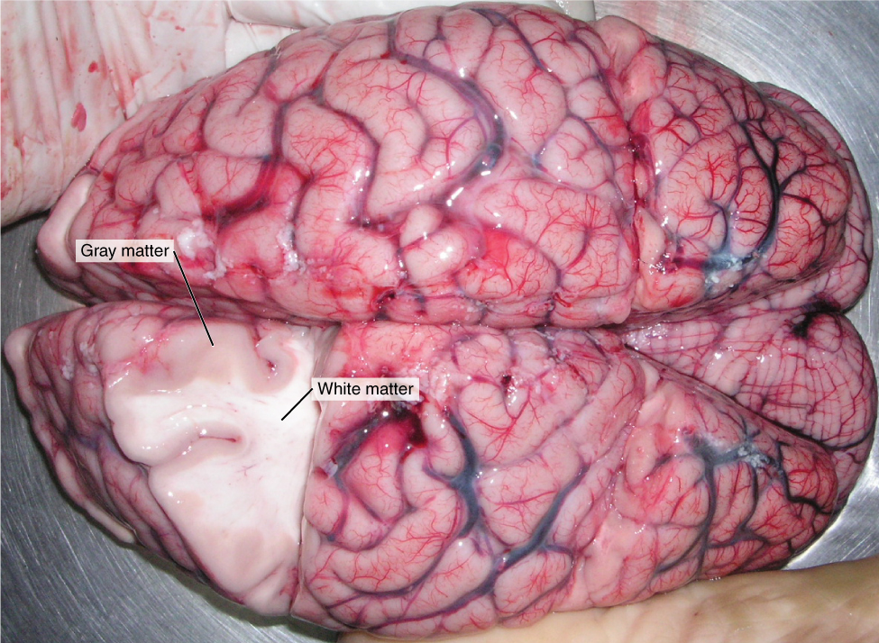 Gray matter and white matter of the brain. Image description available.